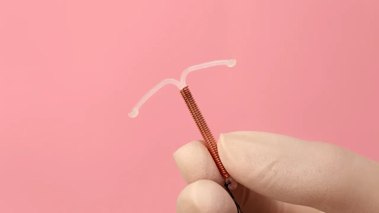 DIU (Dispositivo Intrauterino)