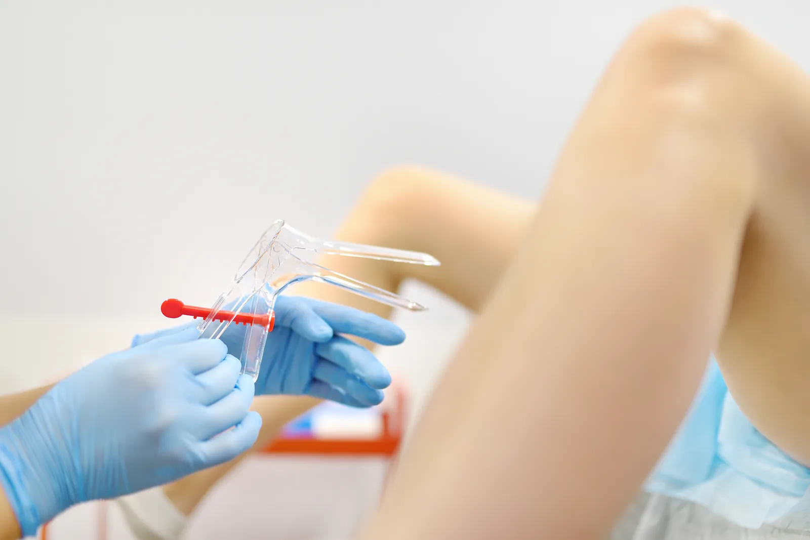 ¿Es doloroso el cultivo vaginal? ¿Es doloroso el cultivo vaginal?